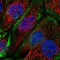 Immunofluorescent staining of human cell line A-431 shows localization to plasma membrane.
