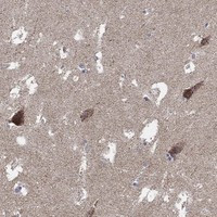 Immunohistochemical staining of human hippocampus shows strong cytoplasmic positivity in neuronal cells.