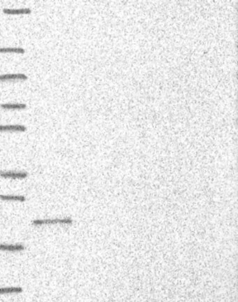 Lane 1: Marker [kDa] 250, 130, 95, 72, 55, 36, 28, 17, 10 | Lane 2: RT4 | Lane 3: U-251 MG | Lane 4: Human Plasma | Lane 5: Liver | Lane 6: Tonsil