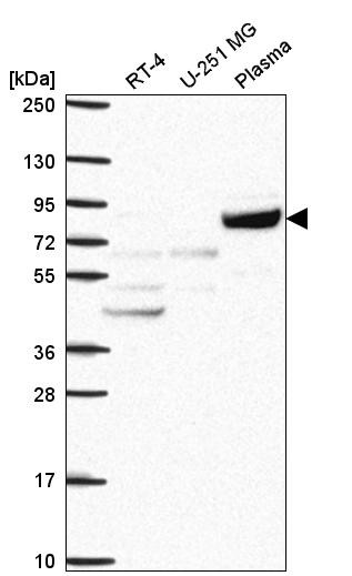 Western blot analysis in human cell line RT-4, human cell line U-251 MG and human plasma.