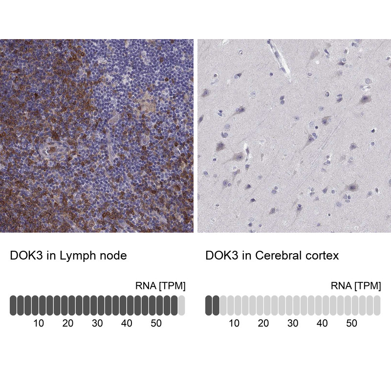 Immunohistochemistry analysis in human lymph node and cerebral cortex tissues using Anti-DOK3 antibody. Corresponding DOK3 RNA-seq data are presented for the same tissues.
