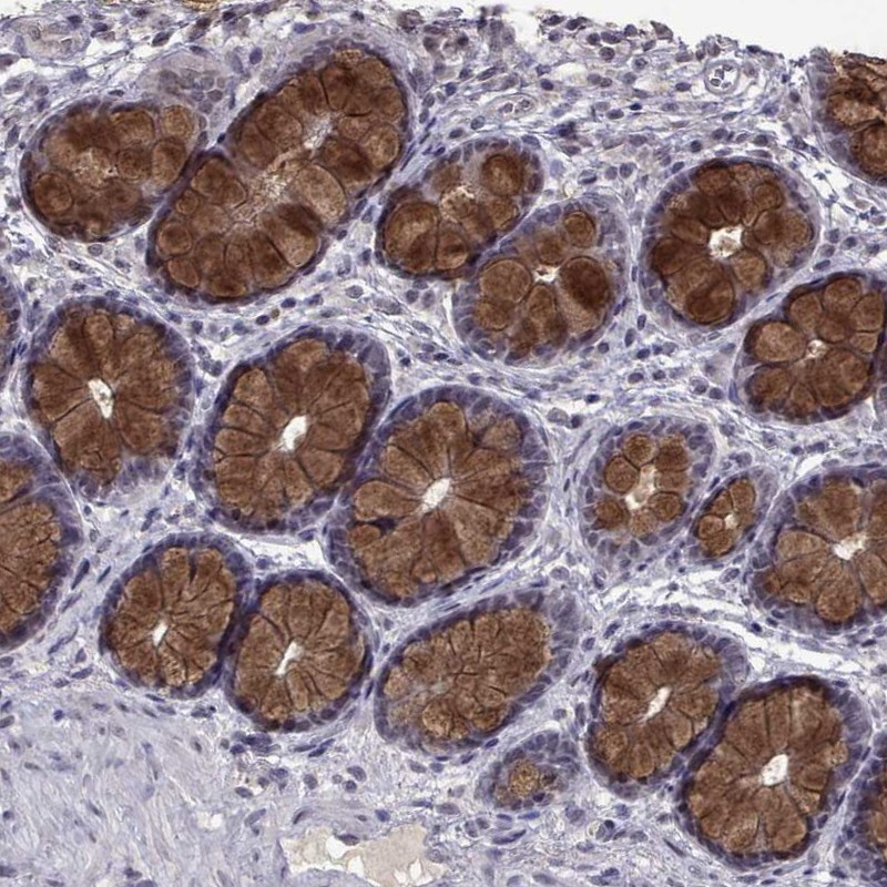 Immunohistochemical staining of human colon shows strong cytoplasmic positivity in glandular cells.
