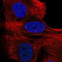 Immunofluorescent staining of human cell line EFO-21 shows localization to nuclear bodies.