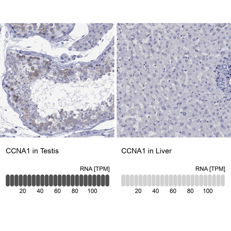 Immunohistochemistry analysis in human testis and liver tissues using Anti-CCNA1 antibody. Corresponding CCNA1 RNA-seq data are presented for the same tissues.
