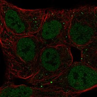 Immunofluorescent staining of human cell line RT4 shows localization to nucleoplasm & vesicles.