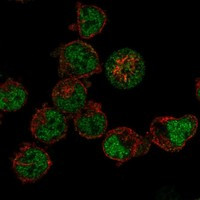 Immunofluorescent staining of human cell line K-562 shows localization to nucleoplasm.
