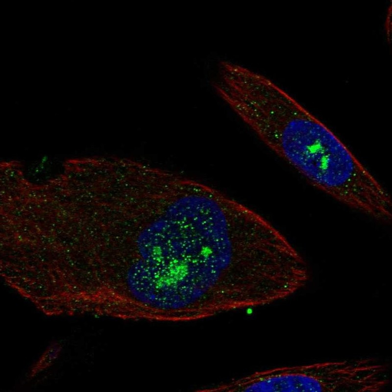 Immunofluorescent staining of human cell line RPTEC TERT1 shows localization to nucleoli.