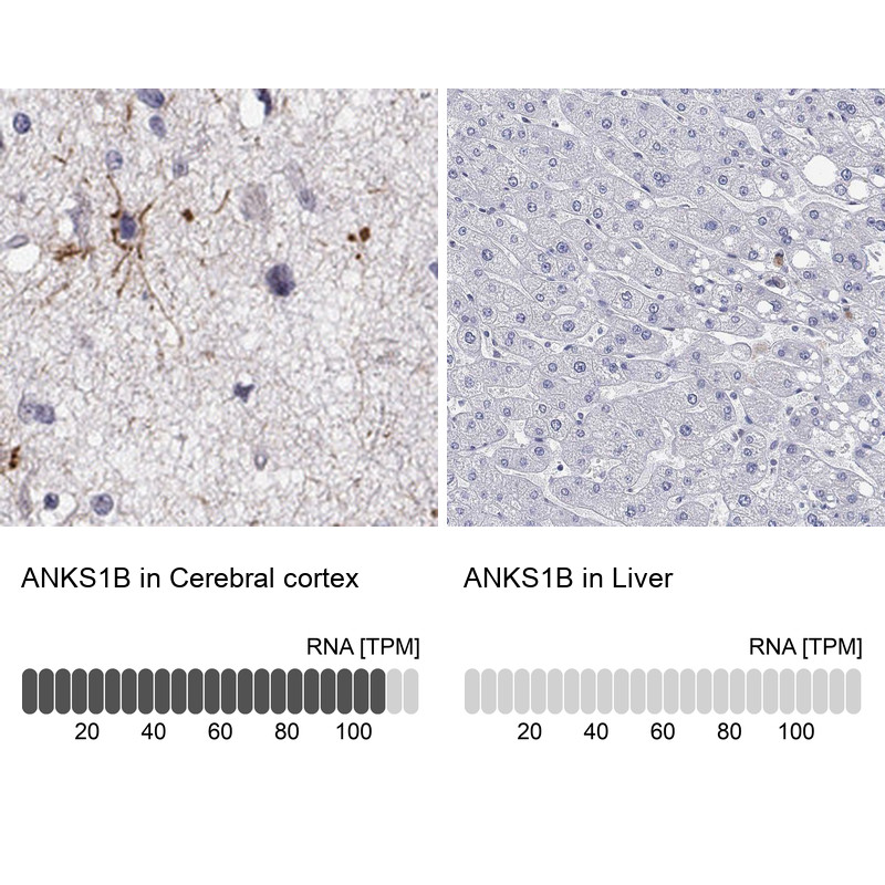 Immunohistochemistry analysis in human cerebral cortex and liver tissues using Anti-ANKS1B antibody. Corresponding ANKS1B RNA-seq data are presented for the same tissues.