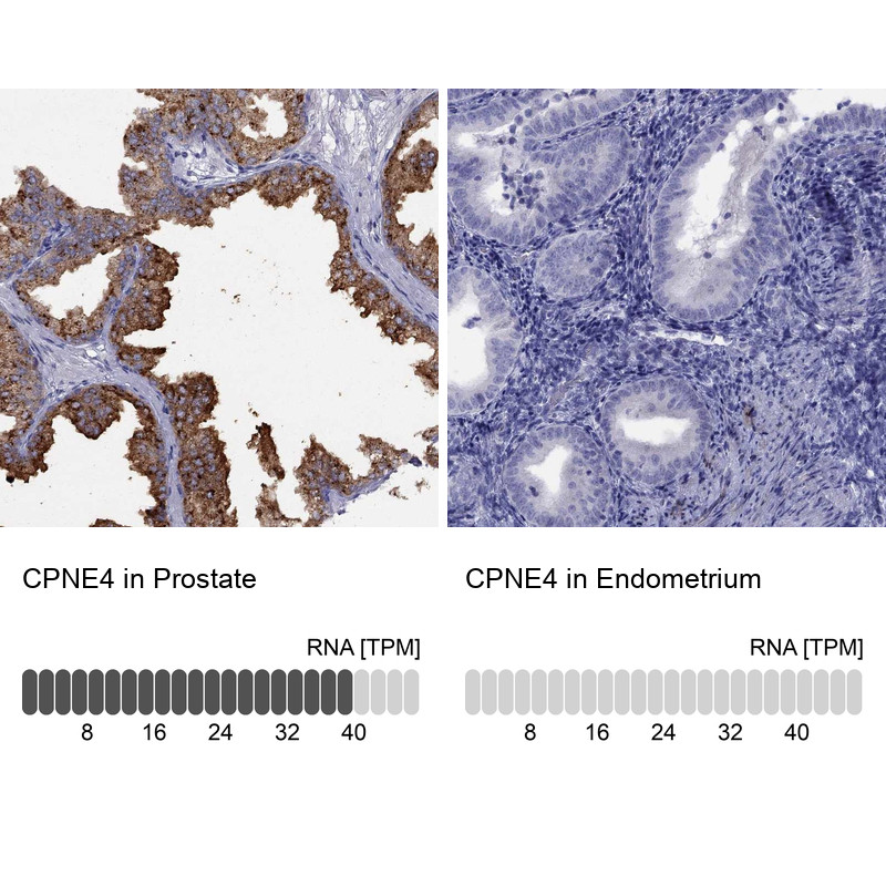 Immunohistochemistry analysis in human prostate and endometrium tissues using Anti-CPNE4 antibody. Corresponding CPNE4 RNA-seq data are presented for the same tissues.