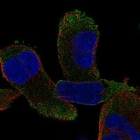 Immunofluorescent staining of human cell line RH-30 shows localization to plasma membrane.