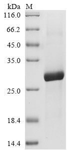 (Tris-Glycine gel) Discontinuous SDS-PAGE (reduced) with 5% enrichment gel and 15% separation gel.