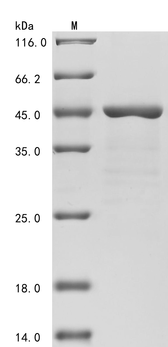 (Tris-Glycine gel) Discontinuous SDS-PAGE (reduced) with 5% enrichment gel and 15% separation gel.