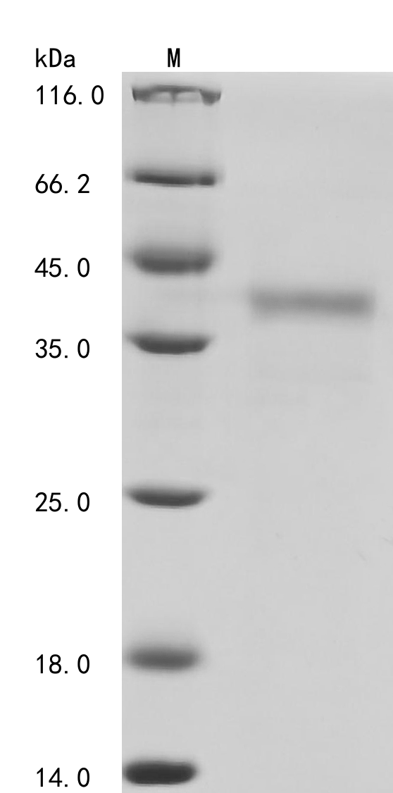 (Tris-Glycine gel) Discontinuous SDS-PAGE (reduced) with 5% enrichment gel and 15% separation gel.
