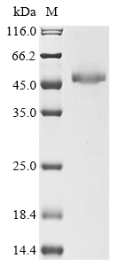 (Tris-Glycine gel) Discontinuous SDS-PAGE (reduced) with 5% enrichment gel and 15% separation gel.