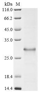 (Tris-Glycine gel) Discontinuous SDS-PAGE (reduced) with 5% enrichment gel and 15% separation gel.