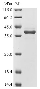 (Tris-Glycine gel) Discontinuous SDS-PAGE (reduced) with 5% enrichment gel and 15% separation gel.