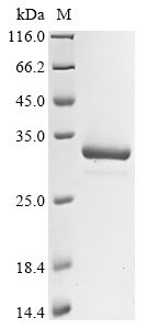 (Tris-Glycine gel) Discontinuous SDS-PAGE (reduced) with 5% enrichment gel and 15% separation gel.
