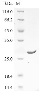 (Tris-Glycine gel) Discontinuous SDS-PAGE (reduced) with 5% enrichment gel and 15% separation gel.