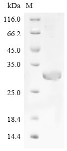 (Tris-Glycine gel) Discontinuous SDS-PAGE (reduced) with 5% enrichment gel and 15% separation gel.