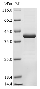 (Tris-Glycine gel) Discontinuous SDS-PAGE (reduced) with 5% enrichment gel and 15% separation gel.