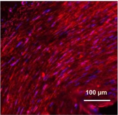 Paraffin-embedded human arterial section (OrigGene #CS808380) was subjected to deparaffinization and pretreatment for 10 min with HistoVT One (Nacalai #06380) in a steam cooker. Staining conditions used are; blocking for 1 h at room temperature with BlockingOne-P (Nacalai #05999), 1st Ab incubation overnight at 4 °C with anti CPI-17 (1:200), 2nd Ab incubation for 1 h at room temperature with Cy3-conjugated anti-rabbit IgG (Jackson ImmunoResearch #111-165-045; Red) and Hoechst dye (0.5 μg/mL; Purple). Imaging was conducted using Keyence BZ (20x objective)