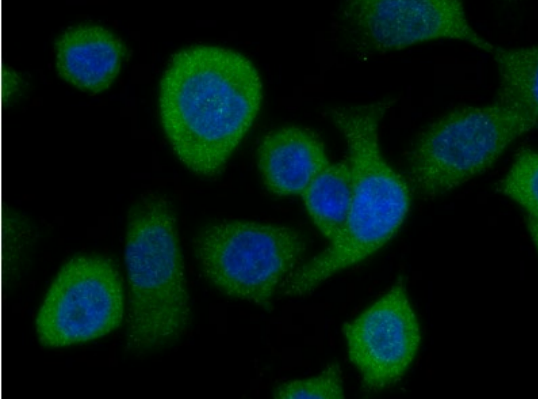Cytoplasmic PODXL staining was observed in S2-013 cells. PODXL
(green)/DAPI (blue). Antibody dilution: 1:1000