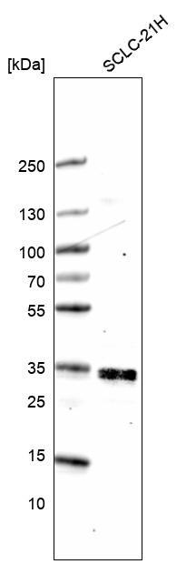 Western blot analysis in human cell line SCLC-21H.