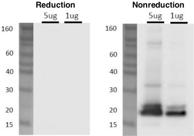 Figure 2. Western blot analysis of CD9 in C32 melanoma cell exosomes using anti-CD9 (12A12) antibody.
Sample: C32 cell Exosome (5ug, 1ug)
Primary antibody: anti-CD9 (12A12) (1ug/mL)
Secondary antibody: anti-mouse IgG-HRP