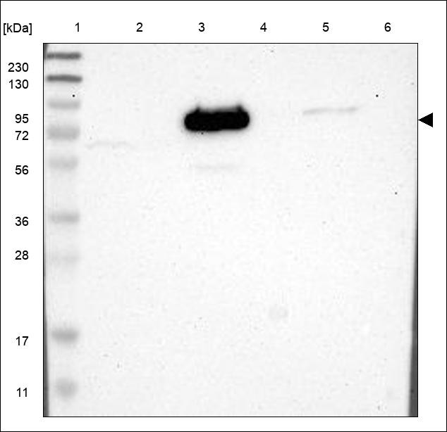 Lane 1: Marker [kDa] 230,130,95,72,56,36,28,17,11 Lane 2: RT4 Lane 3: U-251 MG Lane 4: Human Plasma Lane 5: Liver Lane 6: Tonsil