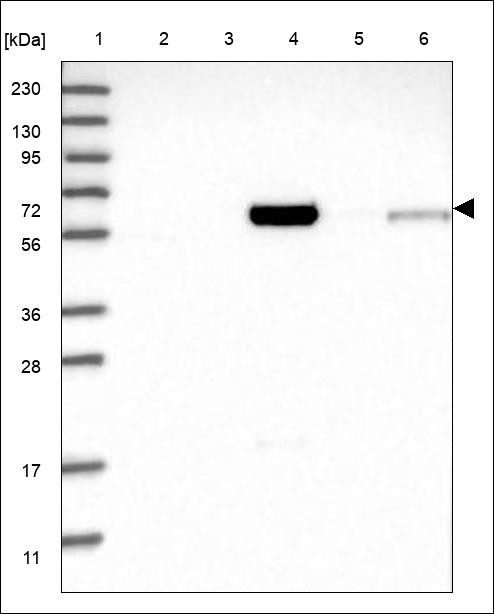 Lane 1: Marker [kDa] 230,130,95,72,56,36,28,17,11 Lane 2: RT4 Lane 3: U-251 MG Lane 4: Human Plasma Lane 5: Liver Lane 6: Tonsil