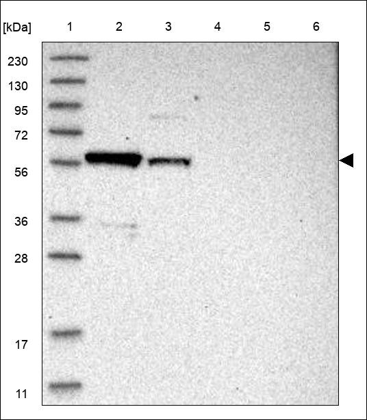 Lane 1: Marker [kDa] 230,130,95,72,56,36,28,17,11 Lane 2: RT4 Lane 3: U-251 MG Lane 4: Human Plasma Lane 5: Liver Lane 6: Tonsil