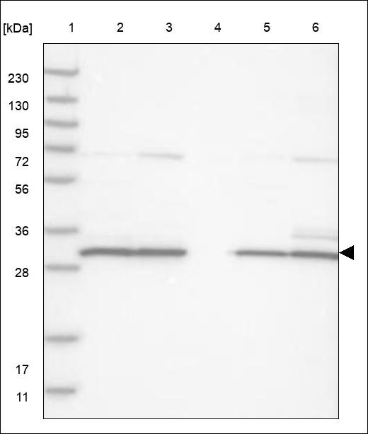 Lane 1: Marker [kDa] 230,130,95,72,56,36,28,17,11 Lane 2: RT4 Lane 3: U-251 MG Lane 4: Human Plasma Lane 5: Liver Lane 6: Tonsil