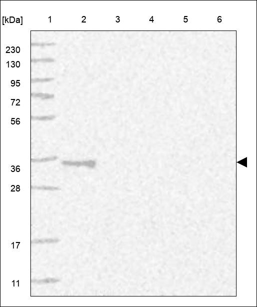 Lane 1: Marker [kDa] 230,130,95,72,56,36,28,17,11 Lane 2: RT4 Lane 3: U-251 MG Lane 4: Human Plasma Lane 5: Liver Lane 6: Tonsil