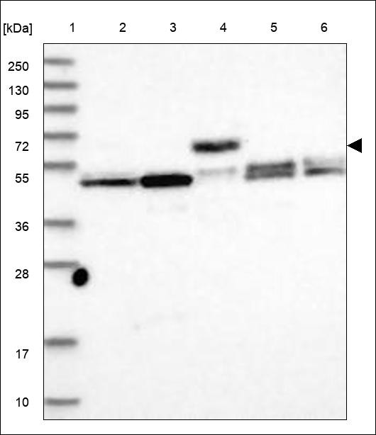 Lane 1: Marker [kDa] 250,130,95,72,55,36,28,17,10 Lane 2: RT4 Lane 3: U-251 MG Lane 4: Human Plasma Lane 5: Liver Lane 6: Tonsil