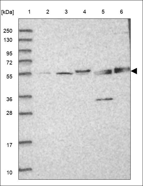 Lane 1: Marker [kDa] 250,130,95,72,55,36,28,17,10 Lane 2: RT4 Lane 3: U-251 MG Lane 4: Human Plasma Lane 5: Liver Lane 6: Tonsil
