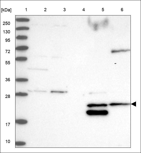 Lane 1: Marker [kDa] 250,130,95,72,55,36,28,17,10 Lane 2: RT4 Lane 3: U-251 MG Lane 4: Human Plasma Lane 5: Liver Lane 6: Tonsil