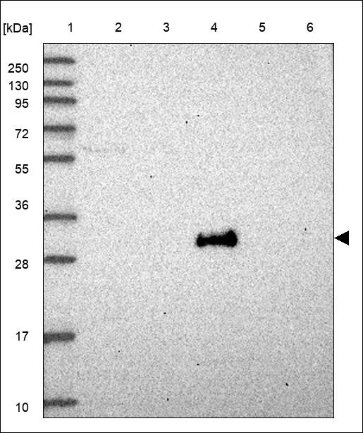 Lane 1: Marker [kDa] 250,130,95,72,55,36,28,17,10 Lane 2: RT4 Lane 3: U-251 MG Lane 4: Human Plasma Lane 5: Liver Lane 6: Tonsil