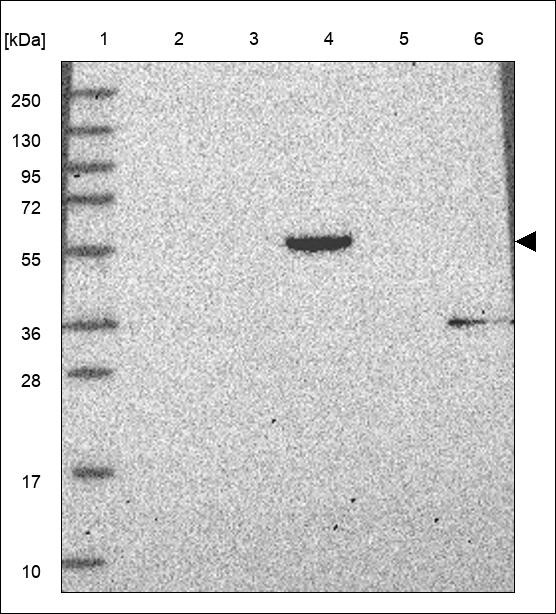 Lane 1: Marker [kDa] 250,130,95,72,55,36,28,17,10 Lane 2: RT4 Lane 3: U-251 MG Lane 4: Human Plasma Lane 5: Liver Lane 6: Tonsil