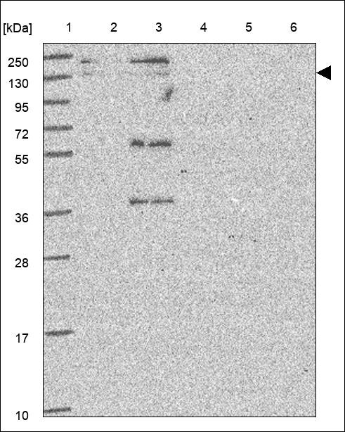 Lane 1: Marker [kDa] 250,130,95,72,55,36,28,17,10 Lane 2: RT4 Lane 3: U-251 MG Lane 4: Human Plasma Lane 5: Liver Lane 6: Tonsil