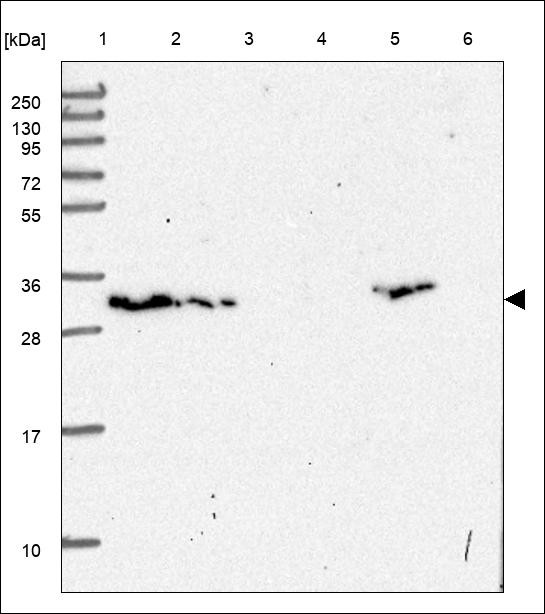 Lane 1: Marker [kDa] 250,130,95,72,55,36,28,17,10 Lane 2: RT4 Lane 3: U-251 MG Lane 4: Human Plasma Lane 5: Liver Lane 6: Tonsil