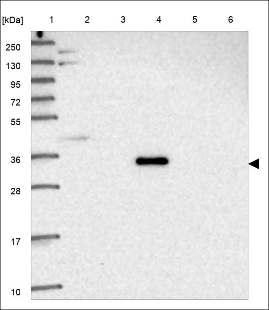 Lane 1: Marker [kDa] 250,130,95,72,55,36,28,17,10 Lane 2: RT4 Lane 3: U-251 MG Lane 4: Human Plasma Lane 5: Liver Lane 6: Tonsil