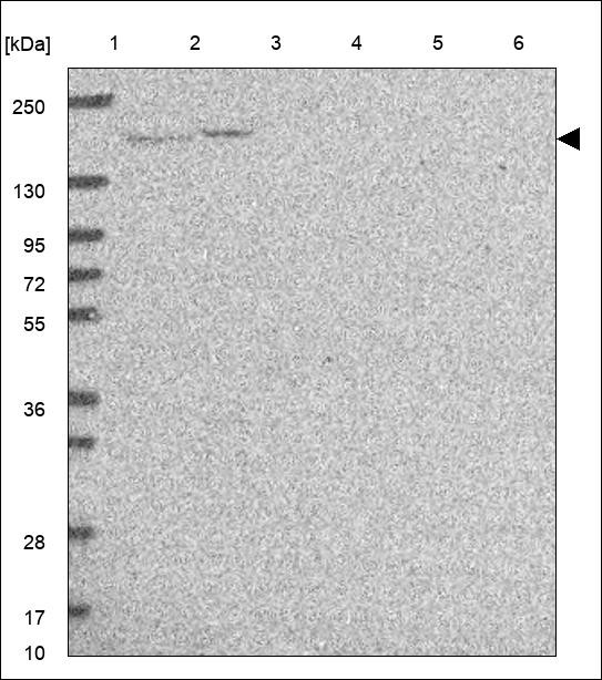 Lane 1: Marker [kDa] 250,130,95,72,55,36,28,17,10 Lane 2: RT4 Lane 3: U-251 MG Lane 4: Human Plasma Lane 5: Liver Lane 6: Tonsil