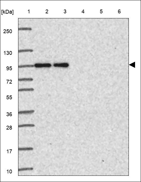 Lane 1: Marker [kDa] 250,130,95,72,55,36,28,17,10 Lane 2: RT4 Lane 3: U-251 MG Lane 4: Human Plasma Lane 5: Liver Lane 6: Tonsil