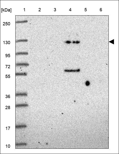 Lane 1: Marker [kDa] 250,130,95,72,55,36,28,17,10 Lane 2: RT4 Lane 3: U-251 MG Lane 4: Human Plasma Lane 5: Liver Lane 6: Tonsil