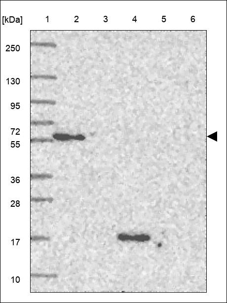 Lane 1: Marker [kDa] 250,130,95,72,55,36,28,17,10 Lane 2: RT4 Lane 3: U-251 MG Lane 4: Human Plasma Lane 5: Liver Lane 6: Tonsil