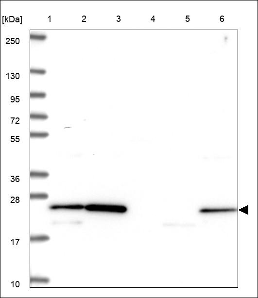 Lane 1: Marker [kDa] 250,130,95,72,55,36,28,17,10 Lane 2: RT4 Lane 3: U-251 MG Lane 4: Human Plasma Lane 5: Liver Lane 6: Tonsil
