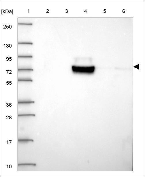 Lane 1: Marker [kDa] 250,130,95,72,55,36,28,17,10 Lane 2: RT4 Lane 3: U-251 MG Lane 4: Human Plasma Lane 5: Liver Lane 6: Tonsil