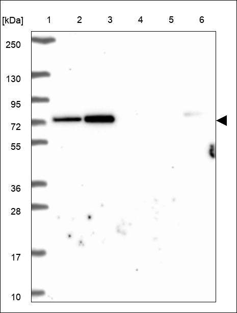 Lane 1: Marker [kDa] 250,130,95,72,55,36,28,17,10 Lane 2: RT4 Lane 3: U-251 MG Lane 4: Human Plasma Lane 5: Liver Lane 6: Tonsil