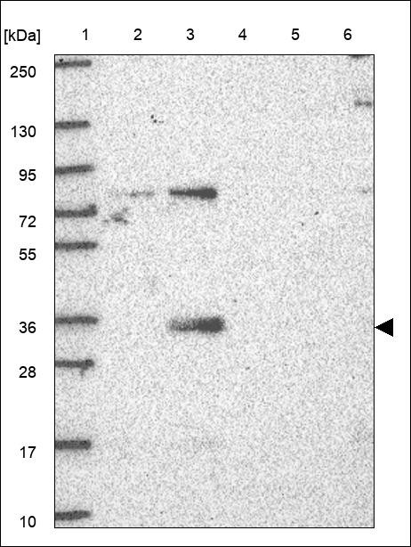 Lane 1: Marker [kDa] 250,130,95,72,55,36,28,17,10 Lane 2: RT4 Lane 3: U-251 MG Lane 4: Human Plasma Lane 5: Liver Lane 6: Tonsil