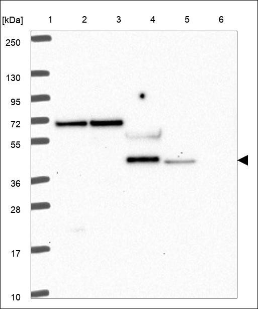 Lane 1: Marker [kDa] 250,130,95,72,55,36,28,17,10 Lane 2: RT4 Lane 3: U-251 MG Lane 4: Human Plasma Lane 5: Liver Lane 6: Tonsil
